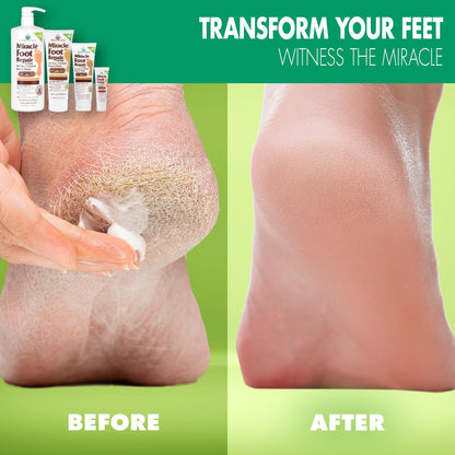 Miracle Foot Repair Cream (4 oz / 2-Pack) Quickly Moisturizes, Softens, And Repairs Cracked Heels